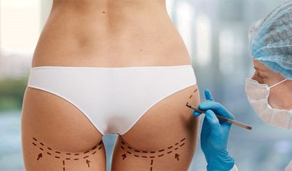 Sezer Marketing olarak teknoloji teknikleri ile estetik medikal turizm alanında sizlere zevkle hizmet vermekteyiz.